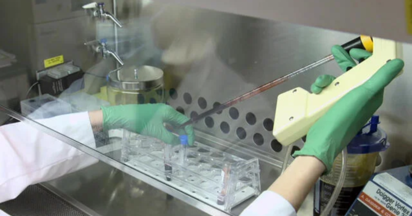 New Jersey Teen Finds Relief After Receiving Groundbreaking Sickle Cell Treatment