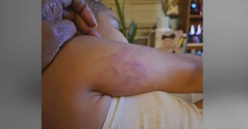 The Teacher Scratched Me: 6-Year-Old Student Allegedly Abused at New Jersey School